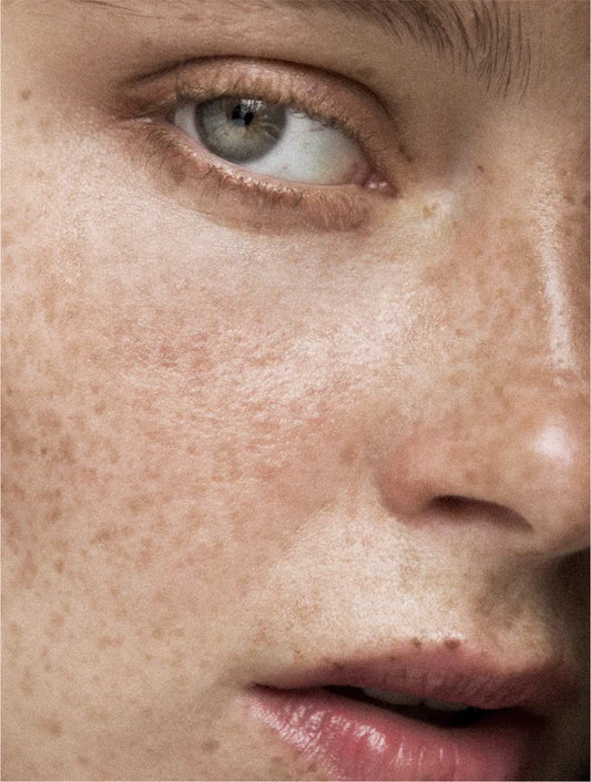 ACTIVE CLARITY – Complexion and Dark Spot Correcting Serum - Vitamin E - 30ml